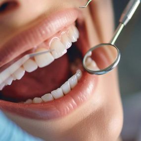 Знижка у розмірі 35% на реставрацію (пломбування) жувальної групи зубів фотокомпозитами від стоматології Dr. Oryshchuk