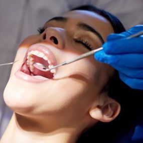 Знижка у розмірі 35% на пломбування каналу та постановка штифта від cтоматології  Dr. Oryshchuk