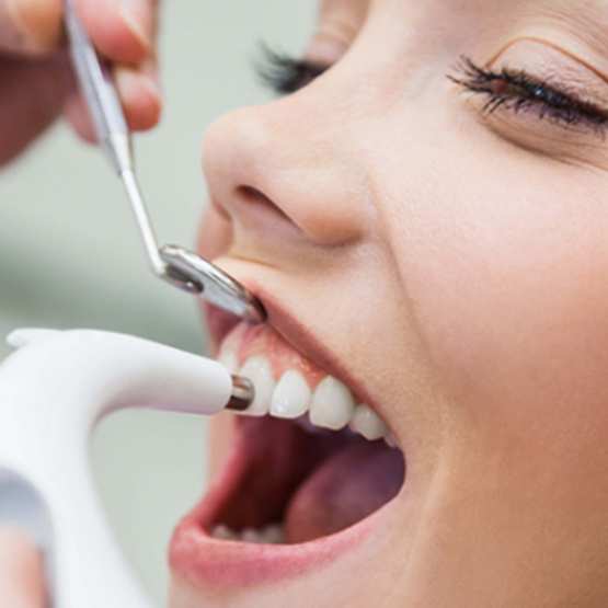 Знижка  100 грн  на фторування зубів (1 щелепа) від стоматологічної клініки «Stomaline»