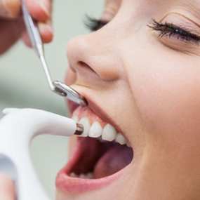 Знижка 50% на фторування зубів (1 щелепа) від стоматологічної клініки «Stomaline»